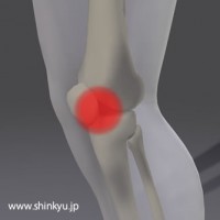 膝の痛み／膝に水が溜まる